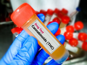 Urine sample for Cannabinoid (THC) drug test.