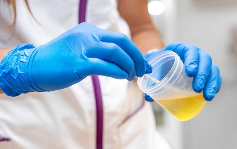 Proposed drug testing procedure requires ‘observed’ urine sample collection in some cases