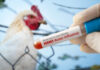 The concept of an avian flu pandemic. A test tube with a blood test for h5n1 avian influenza. Checking chicken for diseases.